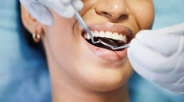 Best Emergency Denture Repair in Tega Cay, SC